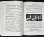 Treatment of the finger contractures. The second volume of the Zimmer's Military medicine – War Experiences 1939–1943. Military Surgery