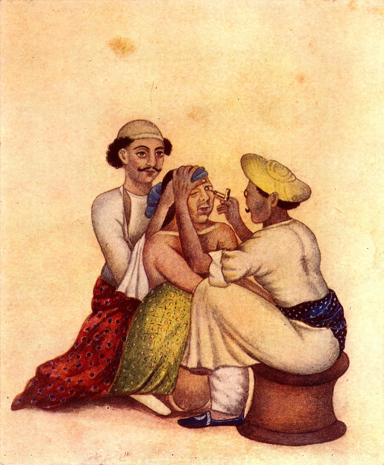 Couching for cataract; Wellcome Collection illustration of Indian doctors performing the technique. Credit: Wikipedia