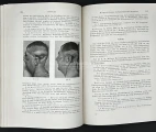 The first volume of the Zimmer's Military medicine – War Experiences 1939–1943. Military Surgery