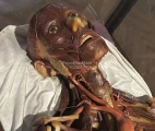 Wax male anatomical model. Josephinum, Medical History Museum Vienna. Photo: Maxim Gorshkov
