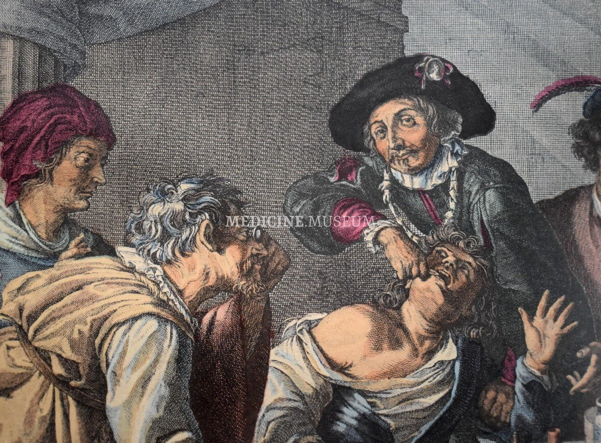 The tooth puller, сolorized French engraving, 18th century, fragment