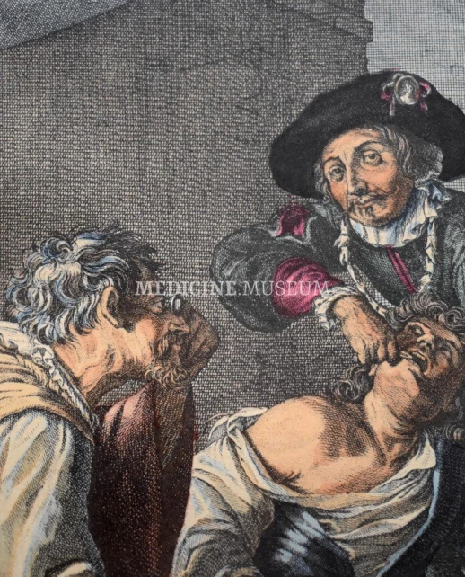 The tooth puller, сolorized French engraving, 18th century, fragment