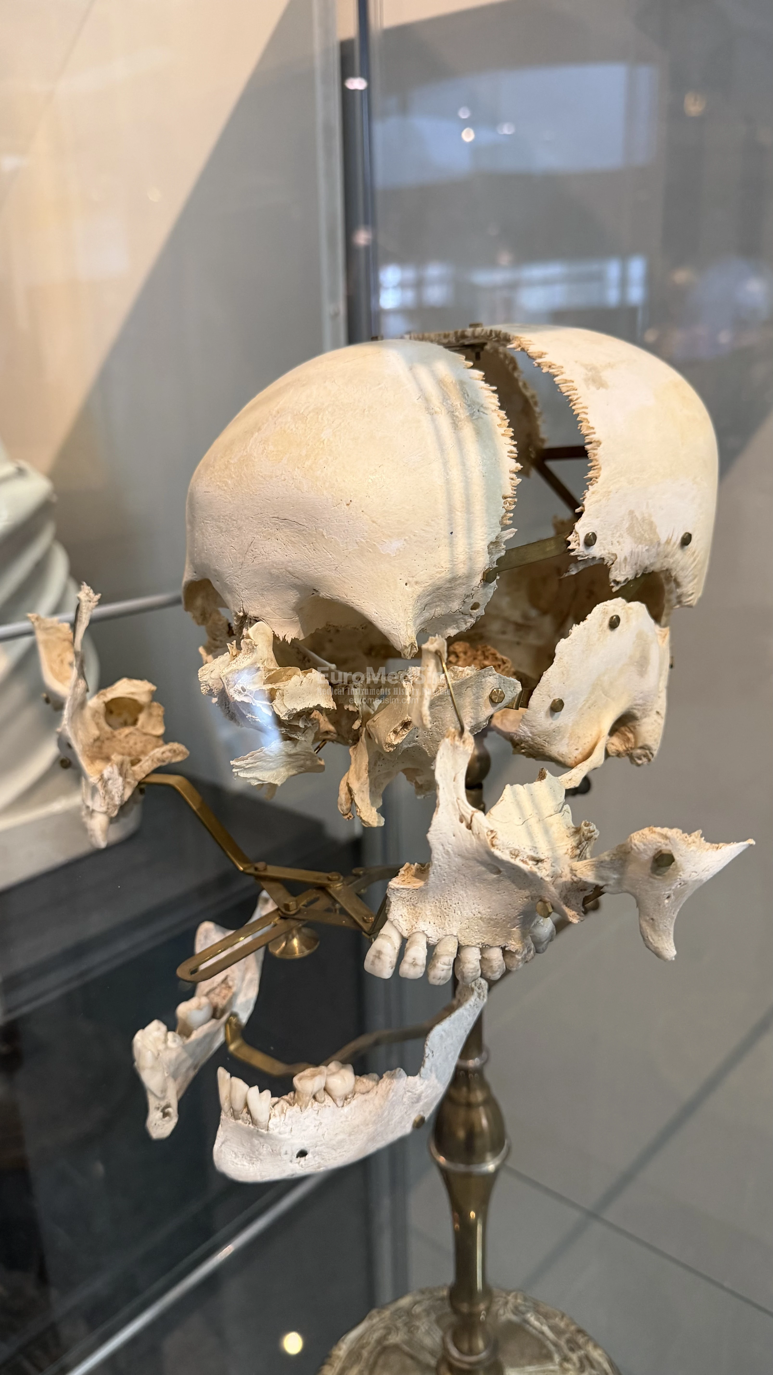 The "flying" model of the skull bones. The Museum of Medicine, Campus Erasme of the Free University of Brussels