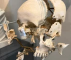 The "flying" model of the skull bones. The Museum of Medicine, Campus Erasme of the Free University of Brussels