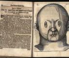 1686-Bartisch-Augen-Dienst Fig.3 depicting a mask for the treatment of strabismus