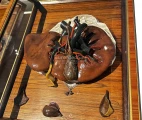 The main arteries, veins and biliary tracts and the gallbladder on the lower surface of the liver