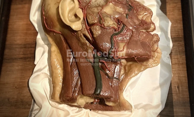 Wax anatomy model of the Head with superficial vessels and nerves