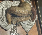 Superficial muscles, vessels and nerves of the stomach, wax model