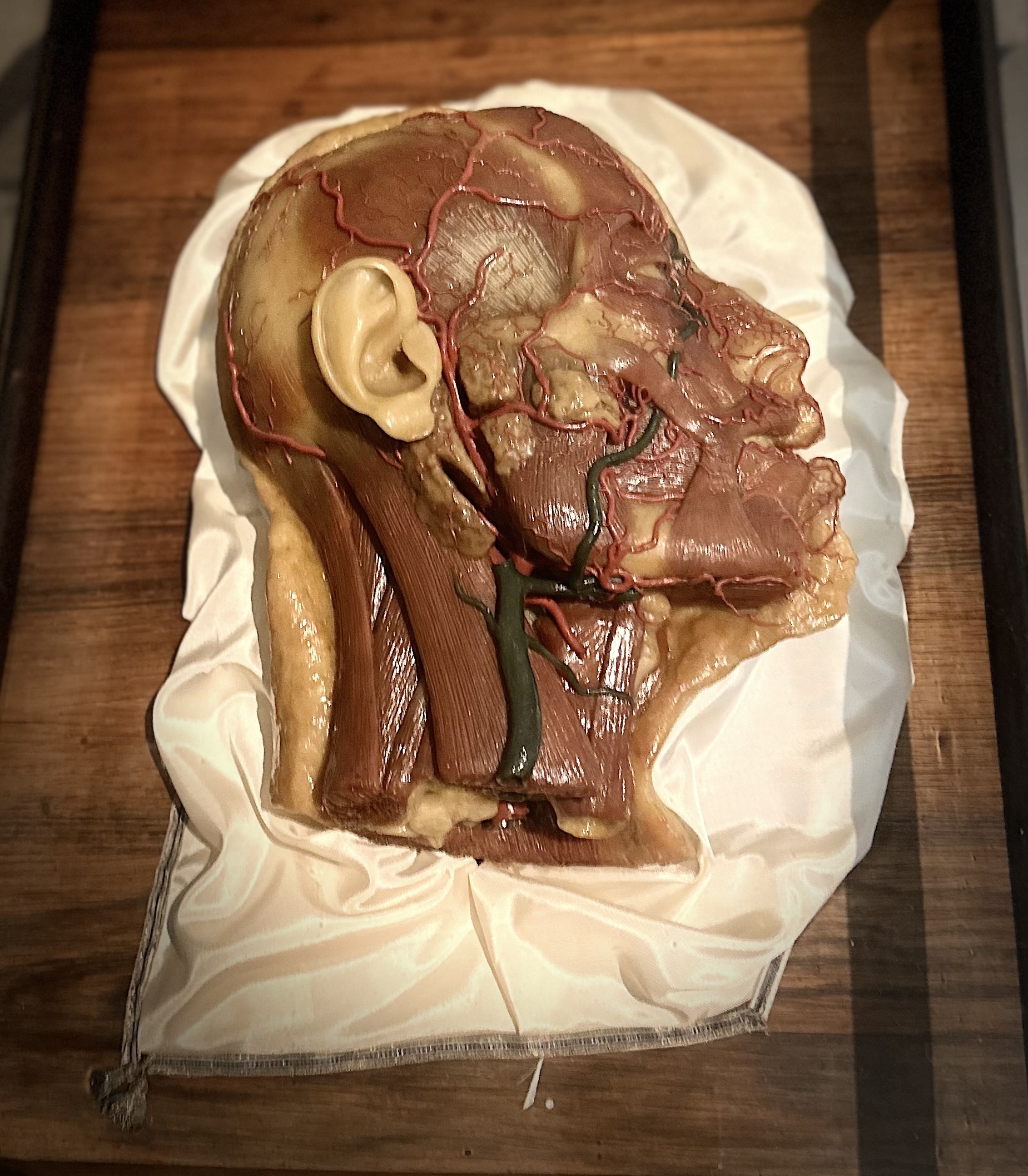 Wax anatomy model of the Head with superficial vessels and nerves