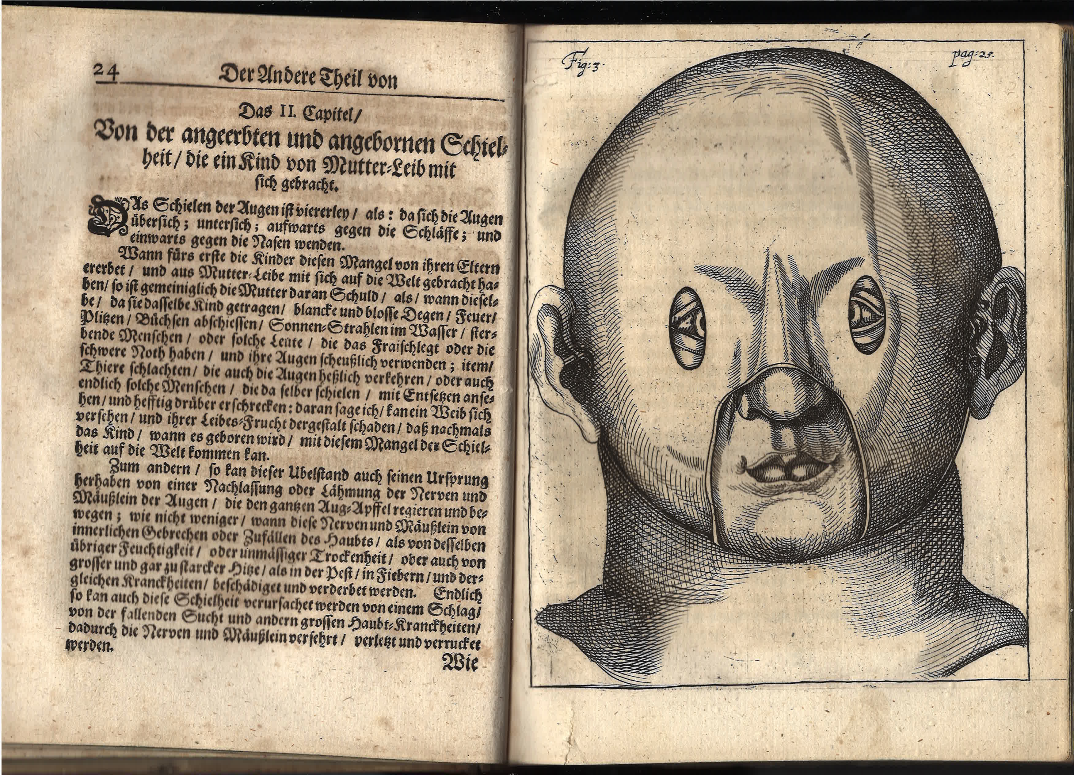 1686 Bartisch Augendienst - mask for strabismus treatment